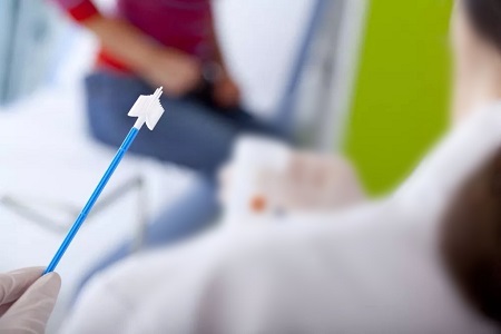 Framsteg i screening av livmoderhalscancer: Rollen för Självuppsamling HPV-test