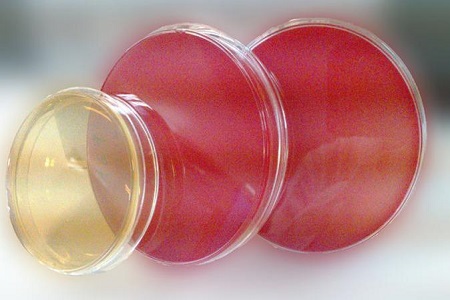 Salmonella Shigella Agar (SS): Det väsentliga mediet för patogenisolering