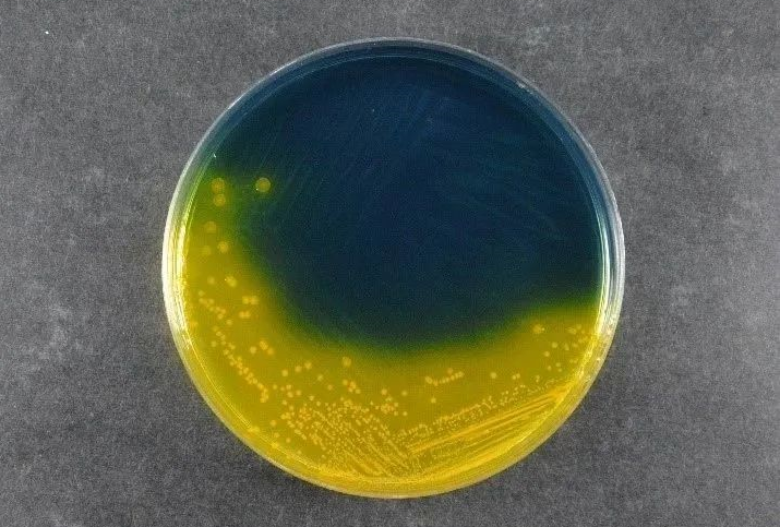 SESIKTERING av livsmedelssäkerhet: Babios Salmonella Shigella Agar (SS) stöder globala patogendetekteringsstandarder