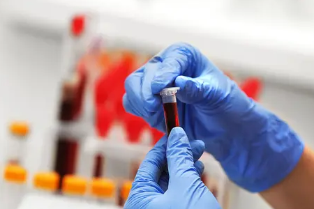 Snabb malariadetektion: BABIO:s testsats för dubbla antigen ger global hälsa