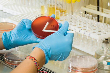 BABIOs MacConkey Agar Medium – Premium Selective Isolation for Global Microbiological Diagnostics