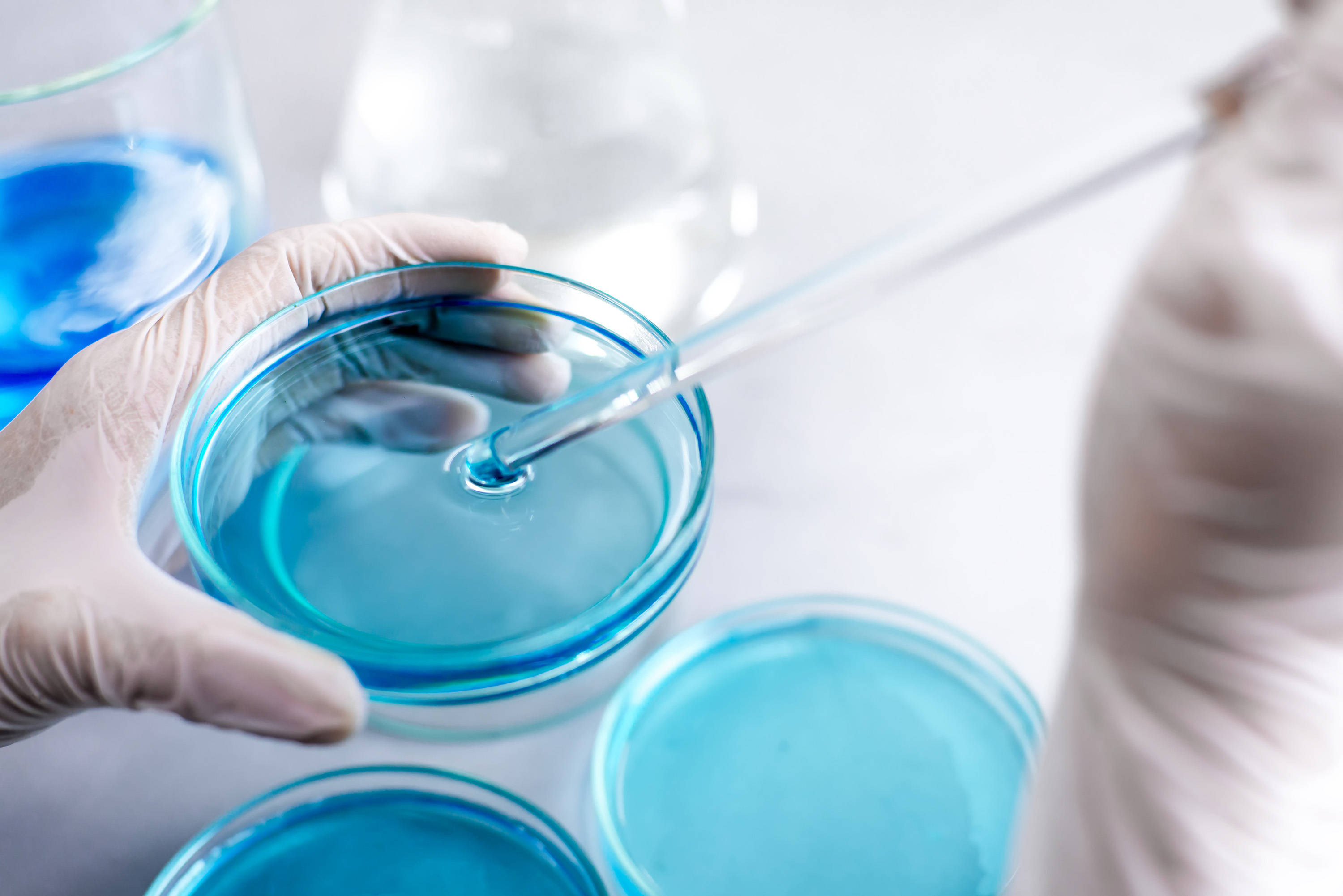 BABIO Nutrient Agar Medium Förbättrar mikrobiell övervakning av miljön